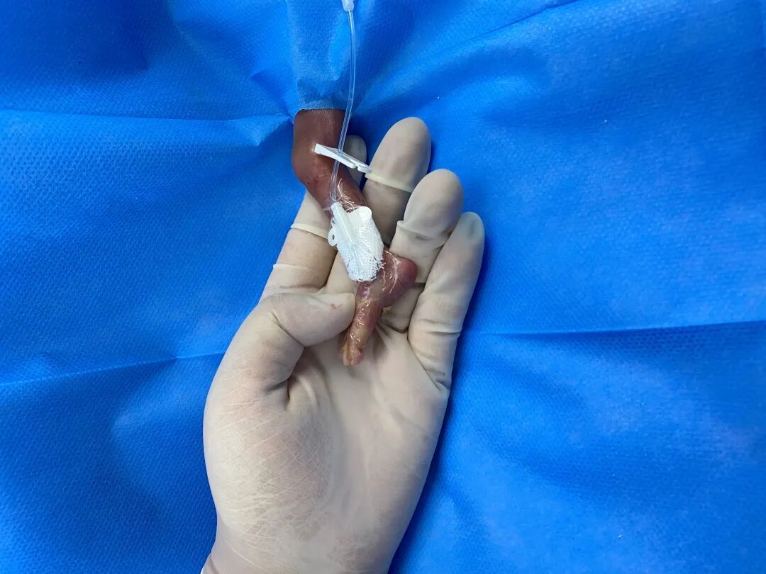 出生体重不足1斤，湖南最小胎龄宝宝出院啦！