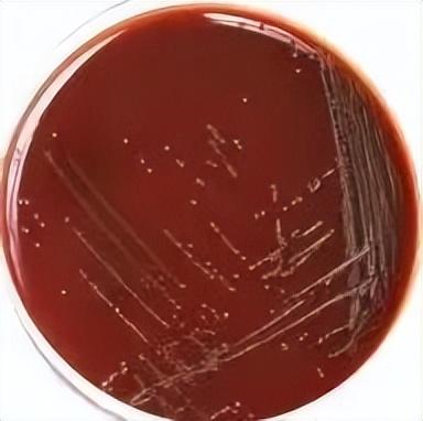 家长必看：建议在这个年龄前，一定给孩子接种流脑疫苗！