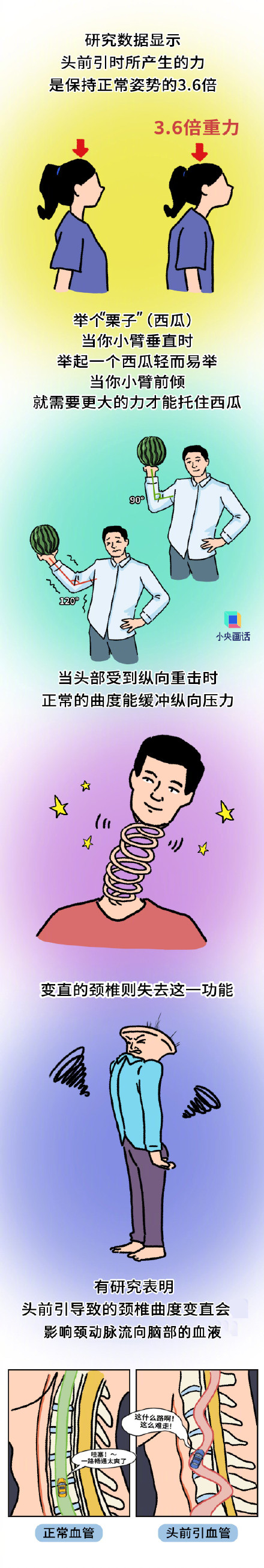 长期脖子前倾可以试试这俩动作