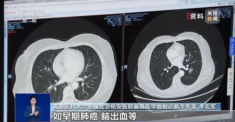 “做核磁被遗忘6小时”，会有辐射伤害吗？