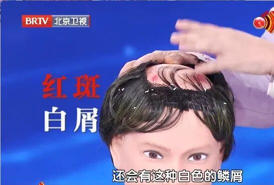 让头发狂掉的真凶是它！赶紧对镜自查，教你“抢救”发量