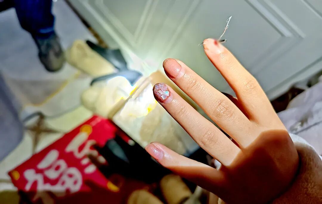 缝纫机“钉”死女子食指，常用机械小心这些致伤风险