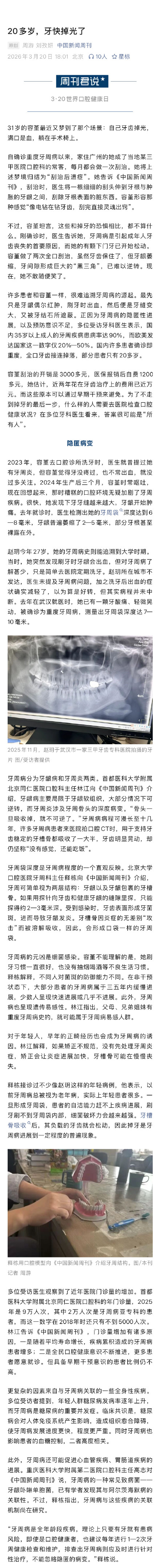 31岁女子确诊重度牙周病不敢随便笑 31岁女子确诊重度牙周病不敢随便笑