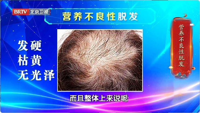 让头发狂掉的真凶是它！赶紧对镜自查，教你“抢救”发量