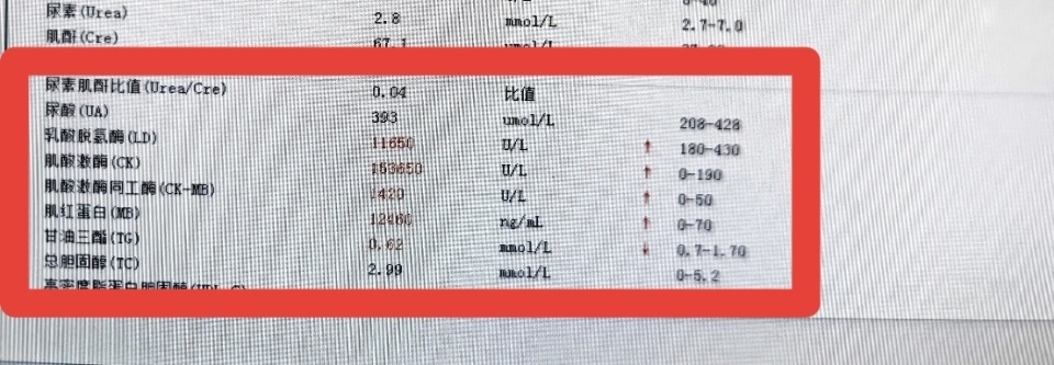 14岁男生冲刺中考体育狂练2小时游泳，竟致“酱油尿”紧急住院