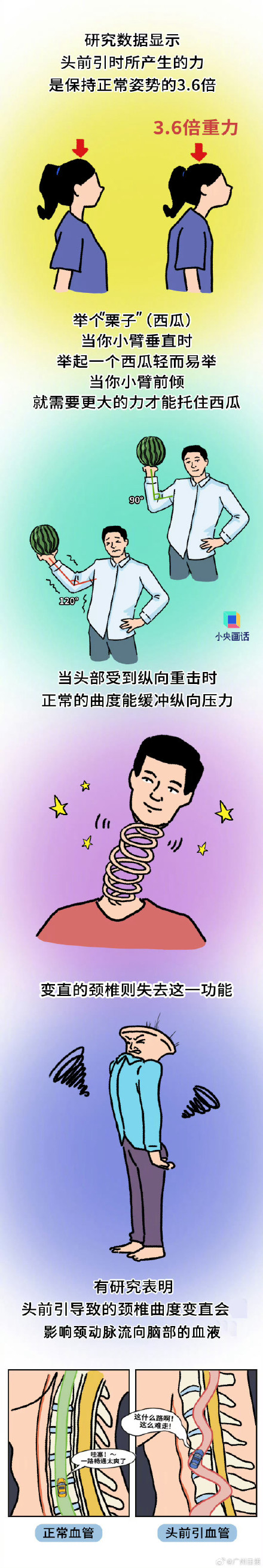 睡眠变差可能是这个动作引起的 睡眠变差可能是这个动作引起的