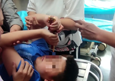 女孩玩“拼豆”突然爆炸起火，反应迅速第一时间拔掉电源