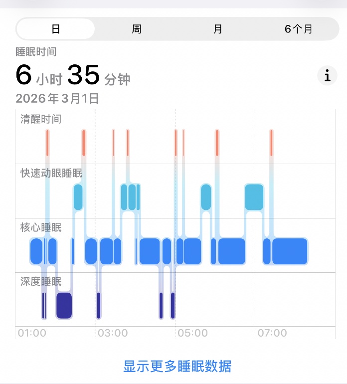 那些用手表监测睡眠的人，越测越睡不好……专家解码睡眠误区