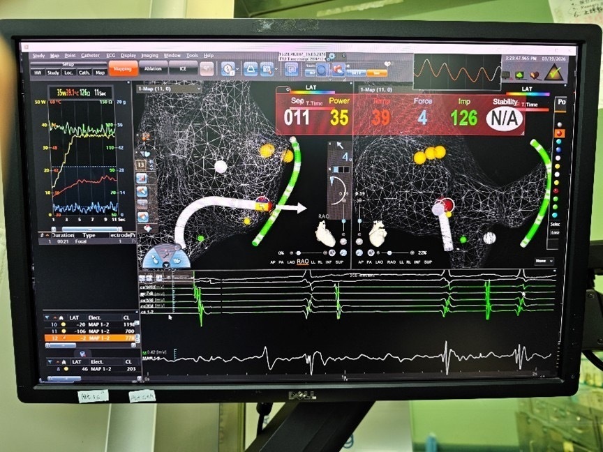 孕30周准妈妈心动过速反复发作,医护“零辐射”为她解除心疾 孕30周准妈妈心动过速反复发作,医护“零辐射”为她解除心疾