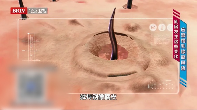 越过这个年龄，患癌的概率就开始变小，做好一件事是关键