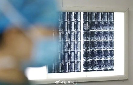 5种炎症可能变成癌症 5种炎症可能变成癌症