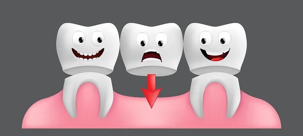 发生车祸被撞坏5颗牙,一次性索赔40年换牙费,法院判了! 发生车祸被撞坏5颗牙,一次性索赔40年换牙费,法院判了!