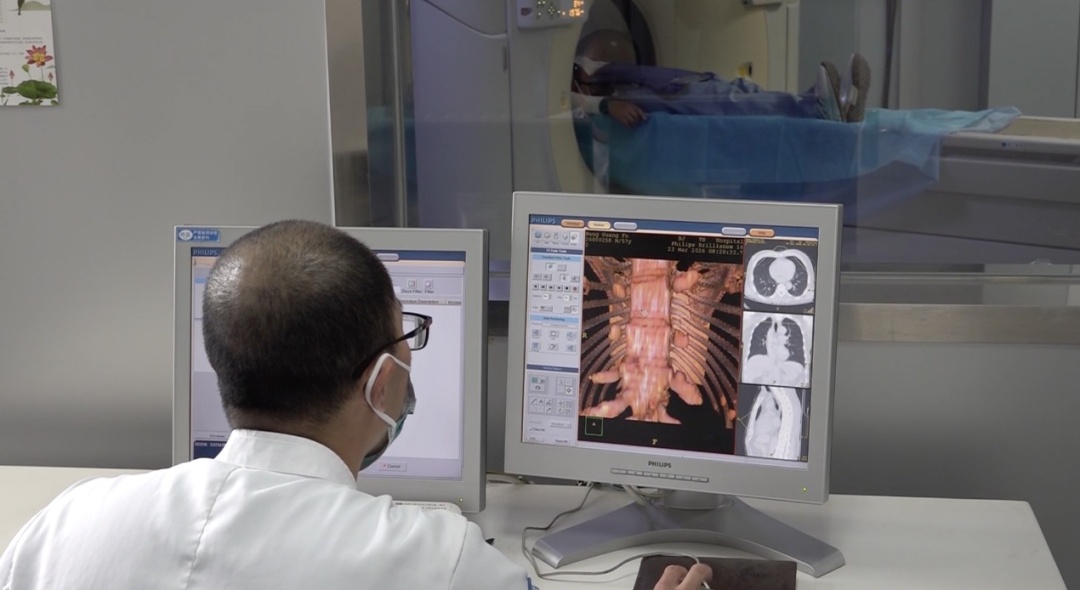 肺结核，人人都可能感染！医生提醒：这样预防——