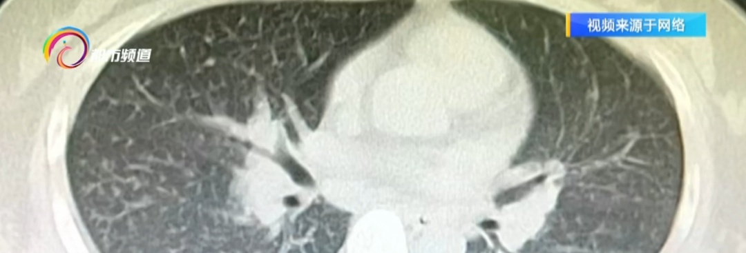 为保孩子健康，女子每天用84消毒液拖地，一个月后自己却进了医院！