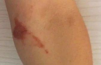 头皮发麻！快检查阳台衣服！这种绿色小颗粒又来了......