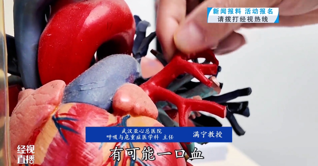 63岁男子十年间反复咯血未重视，病情恶化紧急送医！医生：长年大量吸烟是核心病因