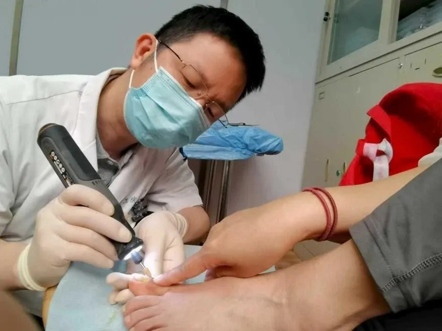 灰指甲为何越治越严重？专家：走对第一步最关键