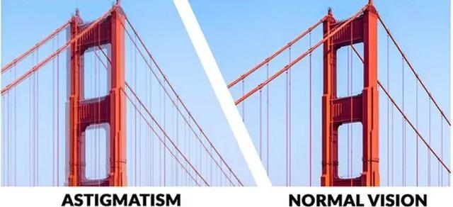 总是模糊重影，看灯会散开，你的眼睛可能出现这种问题了