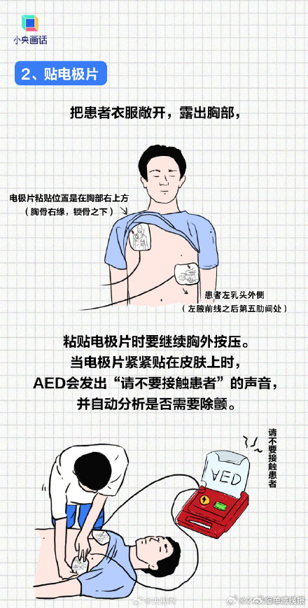 年轻人猝死为什么比老人更凶险