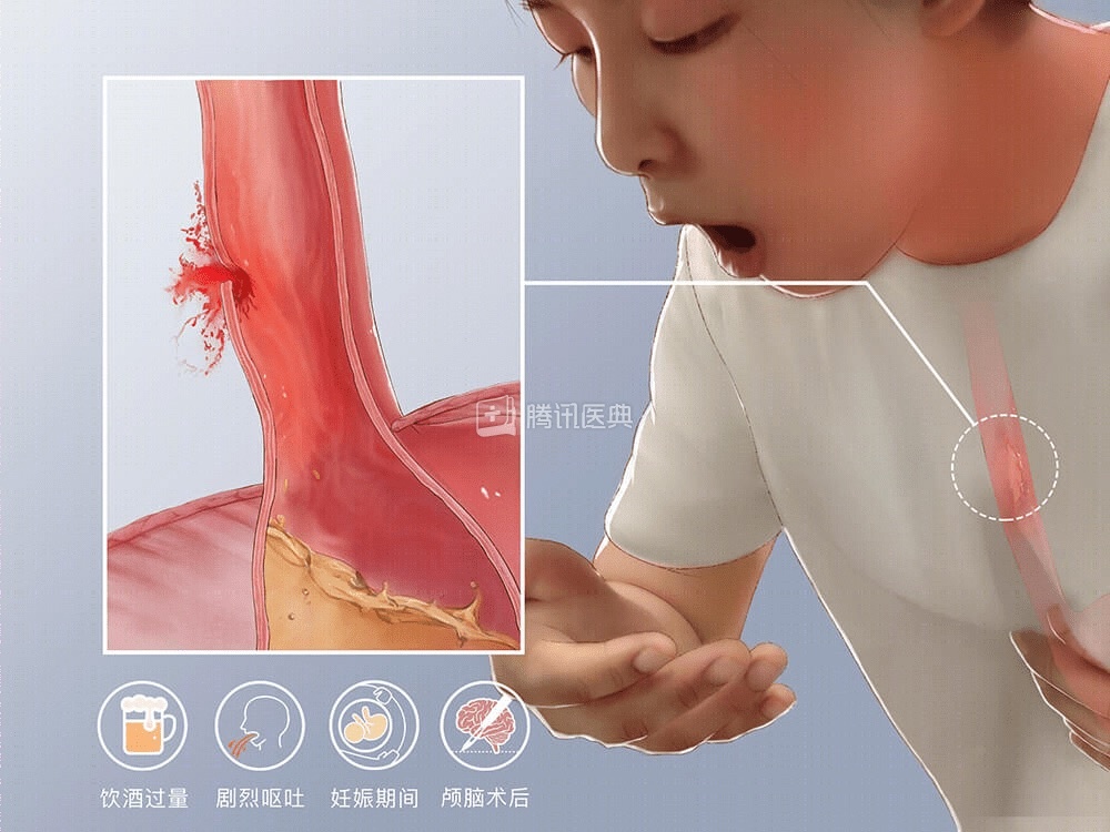 “胸口像被炸开”！吃了2个包子，男子凌晨紧急送医！医生：胸腔里全是剩菜渣