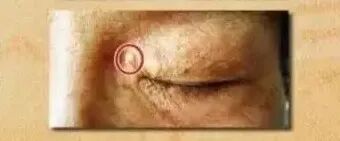 嘴唇发紫是心脏在“求救”？原来心脏不好的人，脸上会“报警”