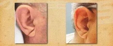 嘴唇发紫是心脏在“求救”？原来心脏不好的人，脸上会“报警”