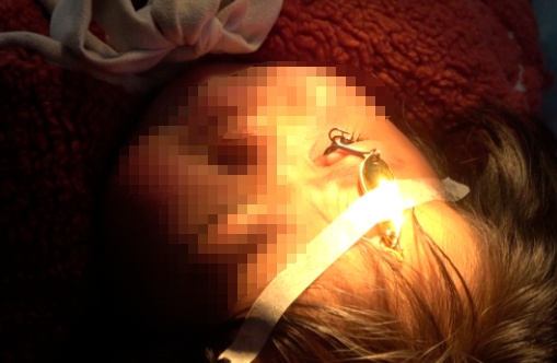 男子甩一竿后戴上“新款耳饰”！消防员医院里“主刀”