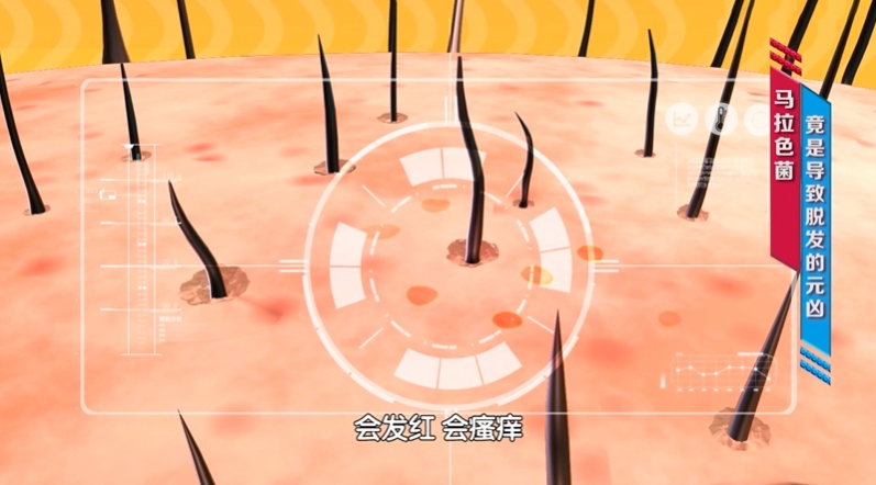 头发2种表现,当心是身体炎症“爆表”了!多吃3种“消炎食物”能改善 头发2种表现,当心是身体炎症“爆表”了!多吃3种“消炎食物”能改善