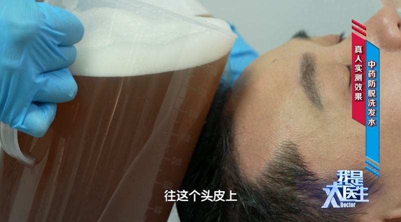 头发2种表现,当心是身体炎症“爆表”了!多吃3种“消炎食物”能改善 头发2种表现,当心是身体炎症“爆表”了!多吃3种“消炎食物”能改善