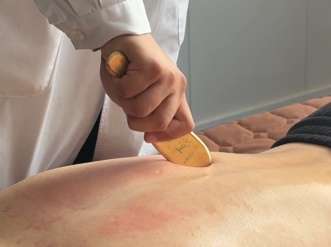 《逐玉》里这个“大招”火了!中医提醒:刮痧不是“万能神技”,这些禁忌别踩坑 《逐玉》里这个“大招”火了!中医提醒:刮痧不是“万能神技”,这些禁忌别踩坑