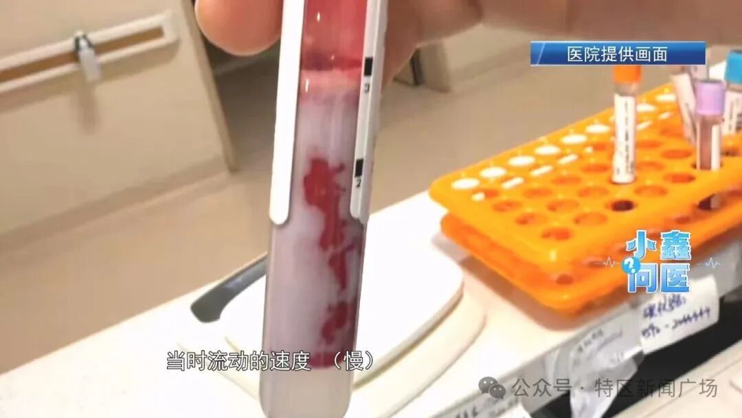 厦门30岁小伙血液变“牛奶血”！竟与吃三文鱼有关？