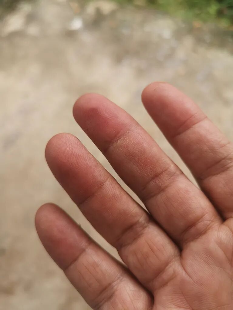 嘴唇发紫是心脏不好？先别急，更重要的是看这一点