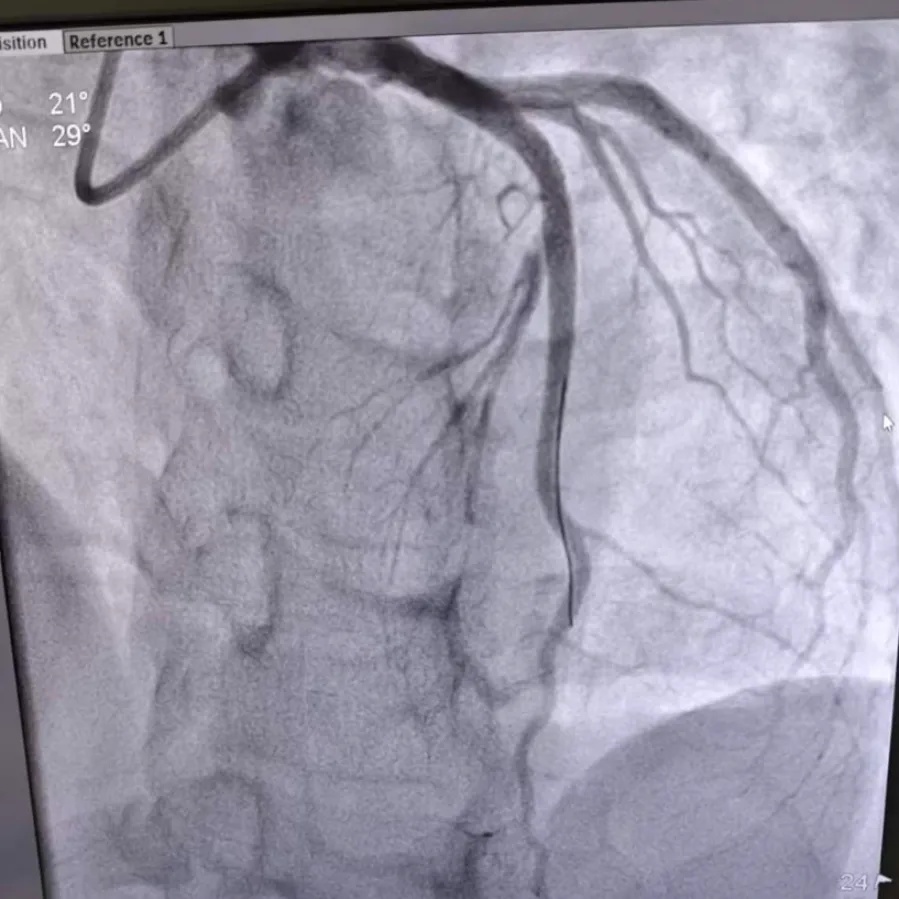 濒死感!浙江33岁小伙梦中因剧痛惊醒,胸口被巨石压住 濒死感!浙江33岁小伙梦中因剧痛惊醒,胸口被巨石压住