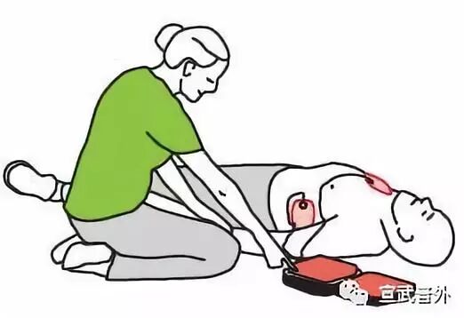 急救黄金4分钟，傻瓜神器助你一臂之力！
