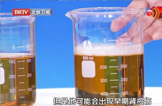 上厕所时有这个变化,当心尿酸“狂飙”!学会2招,赶跑痛风 上厕所时有这个变化,当心尿酸“狂飙”!学会2招,赶跑痛风