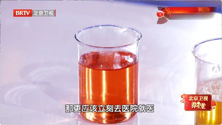 上厕所时有这个变化,当心尿酸“狂飙”!学会2招,赶跑痛风 上厕所时有这个变化,当心尿酸“狂飙”!学会2招,赶跑痛风