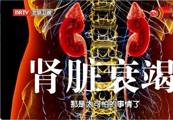 上厕所时有这个变化,当心尿酸“狂飙”!学会2招,赶跑痛风 上厕所时有这个变化,当心尿酸“狂飙”!学会2招,赶跑痛风