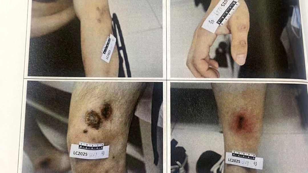 北京:醉驾司机撞飞骑车人后当场逃逸,被路过的群众拦下 北京:醉驾司机撞飞骑车人后当场逃逸,被路过的群众拦下