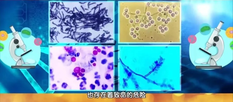 细思极恐！你每天可能都在淋“细菌雨”！有人因此长期咳血……