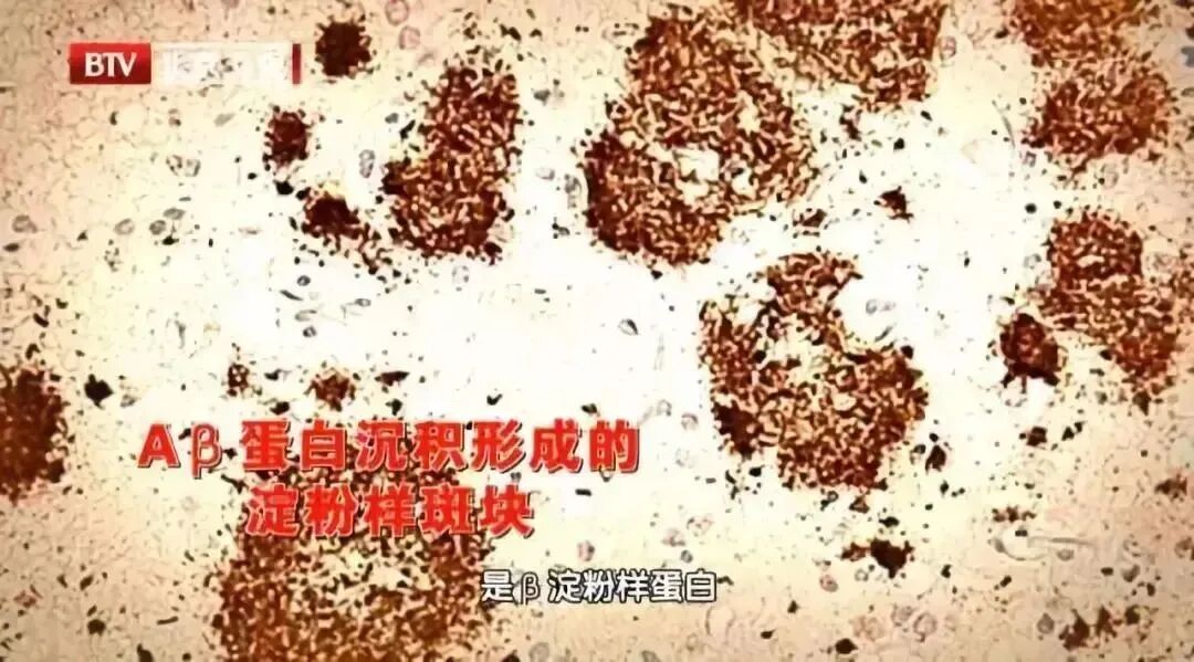 6个“不爱干净”的习惯，医生却直夸健康！最后1个真的没想到…