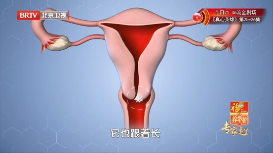 80%女性都躲不过的病毒，反复感染会癌变，教你2招，把风险挡在门外