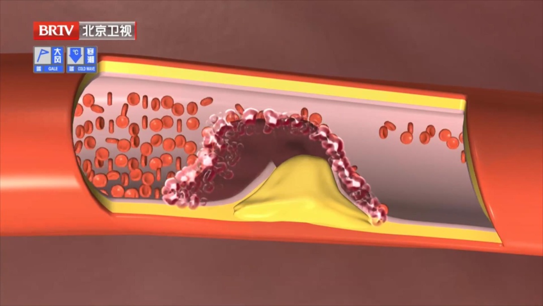 测脑龄只需 1 分钟,吃对食物健脑更灵活 测脑龄只需 1 分钟,吃对食物健脑更灵活