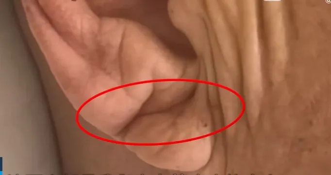 警惕！脸上出现这两个变化，可能是猝死先兆……