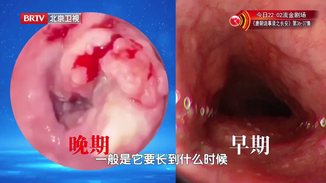 这10个身体信号，藏着癌症的“悄悄话”！不疼不痒也别大意