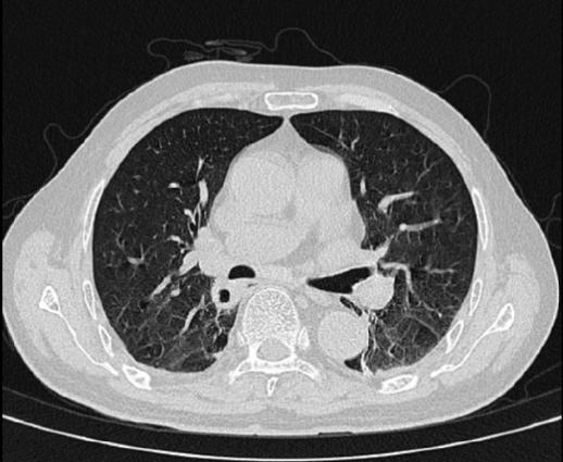 没有伤口、没碰脏物，它却“钻”进大脑和肺…差点要了他的命！