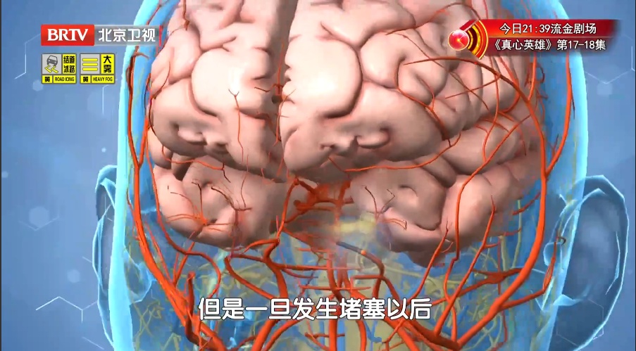 迟1小时，大脑老化3.6年，脑细胞死百万个！新版“中风120”口诀，快收藏能救命