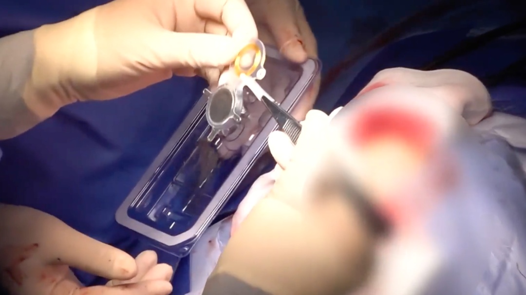 瘫痪9年后，他躺上手术台，这次他要“握住”生活——