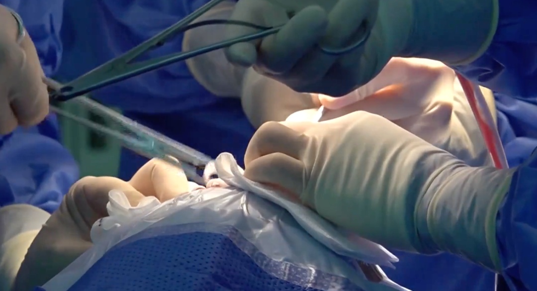 瘫痪9年后，他躺上手术台，这次他要“握住”生活——