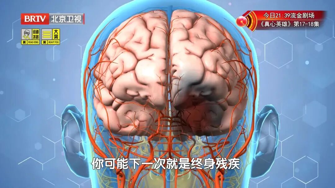 迟1小时，大脑老化3.6年，脑细胞死百万个！新版“中风120”口诀，快收藏能救命