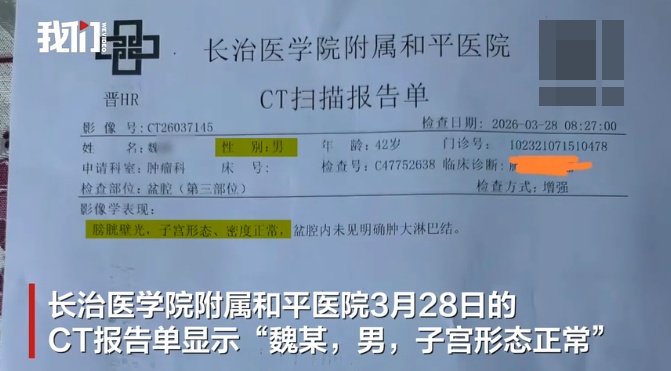 男性患者CT报告显示“子宫形态、密度正常”？医院回应
